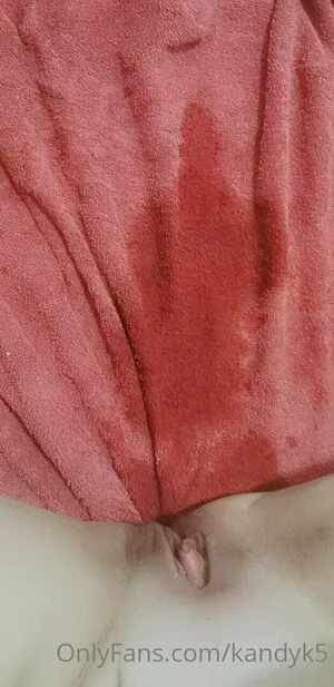 Kandyk5 OnlyFans Leaked Free Thumbnail Picture - #xqMFaSTems