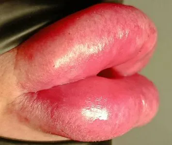 Lip Expansion Doll Thumbnail Picture