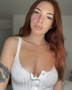 Llo OnlyFans Leaked Free Thumbnail Picture - #ELcnRnK6f2
