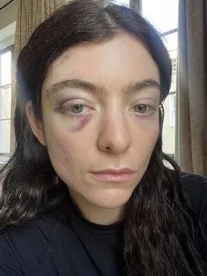 Lorde OnlyFans Leaked Free Thumbnail Picture - #WfD27NeF9e