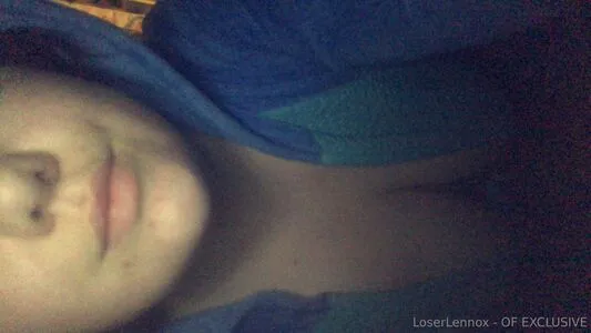 Loserlennox OnlyFans Leaked Free Thumbnail Picture - #hsbFoRMbWM