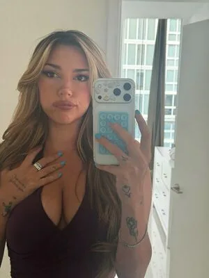Mole OnlyFans Leaked Free Thumbnail Picture - #XTf5FGQZLa