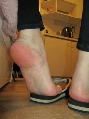 Neolasoles Thumbnail Picture