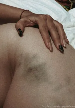 Obs Cure OnlyFans Leaked Free Thumbnail Picture - #QhQCa2ZZFp