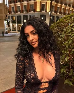 Oops International OnlyFans Leaked Free Thumbnail Picture - #06VN25d3Fs