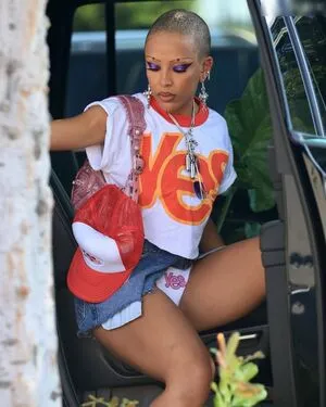 Oops International OnlyFans Leaked Free Thumbnail Picture - #Ybk0IY5D2F