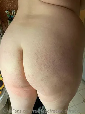 Redheadfreakwithfreckles Thumbnail Picture