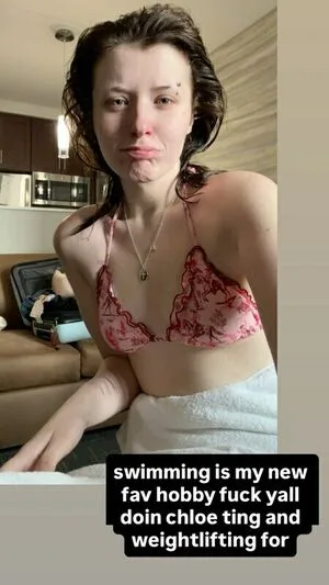 Redtopdocs OnlyFans Leaked Free Thumbnail Picture - #qc1r0kJpvX