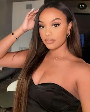 Ruth B OnlyFans Leaked Free Thumbnail Picture - #E5VdlLxFO0