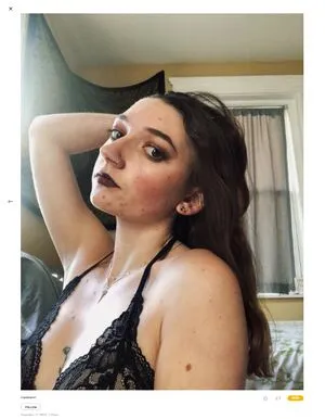 Sprattzz OnlyFans Leaked Free Thumbnail Picture - #4BdakVud1v