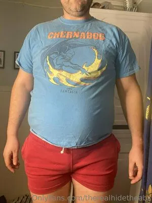 Therealhidetheabs OnlyFans Leaked Free Thumbnail Picture - #zAWU1IKS8b