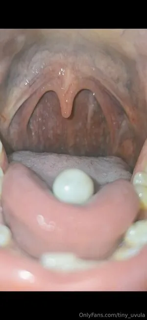 Tiny Uvula OnlyFans Leaked Free Thumbnail Picture - #ffwo24r9vO