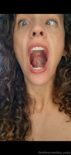 Tiny Uvula Thumbnail Picture