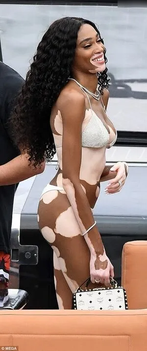 Winnie Harlow OnlyFans Leaked Free Thumbnail Picture - #lIJVlFo7dS