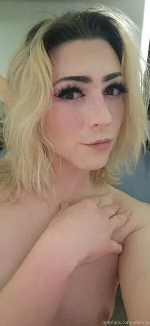 Xdannix OnlyFans Leaked Free Thumbnail Picture - #pho166mtTH